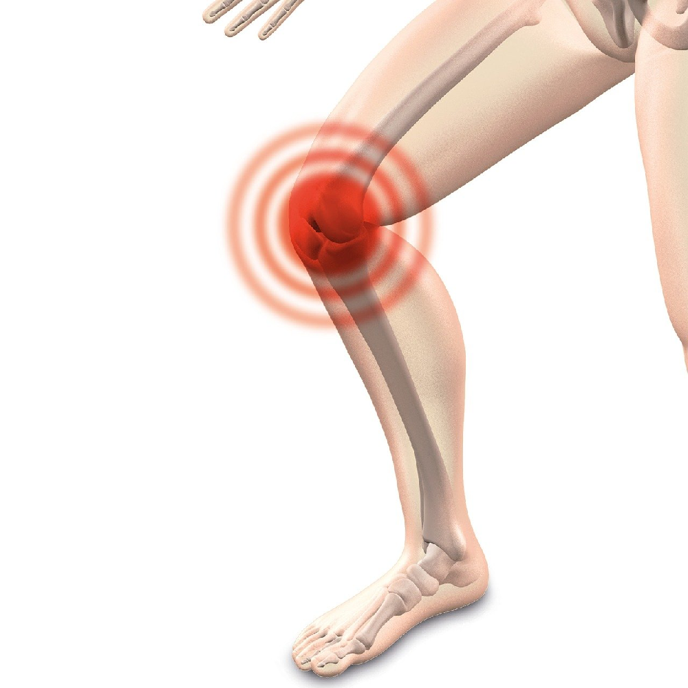 Zerwanie więzadła pobocznego kolana - co warto wiedzieć na ten temat?